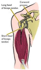Image result for Biceps Tendon Injection