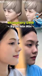 Dr.Min Win🧑‍⚕️International Cosmetic Surgery (@dr.minwin) • Instagram  photos and videos