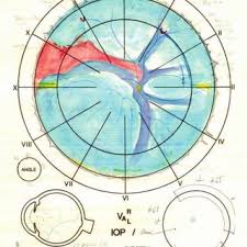 Pdf Retinal Drawing A Lost Art Of Medicine