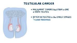 The most common sign of testicular cancer is any kind of lump, hardness, mass, or irregularity inside your testicle. Testicular Torsion What Is It Causes Pain Appearance Treatment And More Osmosis