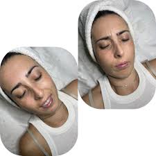 Trattamento viso 🅱🆁🅸🅳🅴 👰‍♀️ La nostra bellissima sposina aveva  proprio bisogno di distendere i muscoletti della fronte 💆🏼‍♀️ Unica  seduta una settimana prima dalle nozze per raggiungere un unico obiettivo  🎯 Relaxing