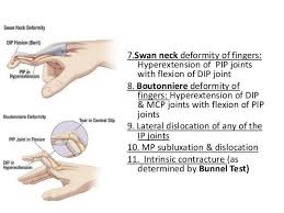 Pin By Dieu Bella On Study Kinesiology Taping Kinesiology Hand Therapy