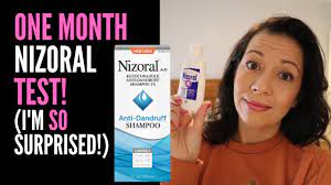 Nizoral is known as a harsh shampoo and i want to be as careful as possible with my scalp and hair. Hair Loss Sufferer Reviews Nizoral Shampoo One Month Review On 2 Ketoconazole I M Very Surprised Youtube