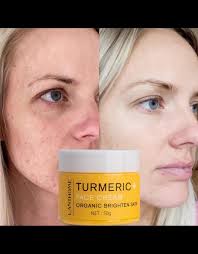 Turmeric has been used for centuries, but applying it directly on your face  isn't always the best idea. Raw turmeric can stain your skin yellow,  trigger allergies, and most importantly there's no