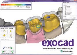 Cad Cam Software Whitepeaks Dental Solutions