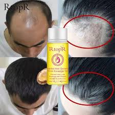 It may take a few more months to tell whether the treatment is working for you. Rtopr Herbal Hair Growth Anti Hair Loss Liquid Promote Thick Fast Hair Growth Treatment 20ml Essential Health Care Beaut Shopee Thailand