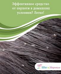 как избавиться от перхоти и выпадения волос в домашних условиях Sredstvo Ot Perhoti Kotoroe Legko Prigotovit Doma Perhot Lechenie Vypadeniya Volos Lico