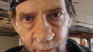 Fundraiser for TODD BEZRUTCZYK by Tiffany Cote : Treatment for quality of  Todd's life