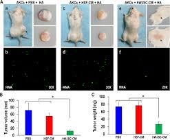 Maybe you would like to learn more about one of these? Inhibition Of Growth Of Asian Keloid Cells With Human Umbilical Cord Wharton S Jelly Stem Cell Conditioned Medium Stem Cell Research Therapy Full Text