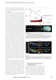 In einem synchrotron oder zyklotron wird ein strahl aus protonen erzeugt und beschleunigt und gezielt auf den tumor geschossen. Die Protonentherapie Rosenfluh Ch