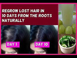 Regrow Lost Hair In 10 Days From The Roots Guaranteed No Hair Loss And Fast Hair Growth Youtube Regrow Lost Hair Lost Hair Hair Loss Remedies