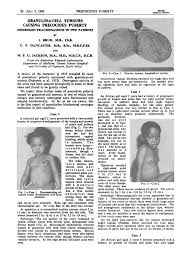 Image result for Precocious Puberty