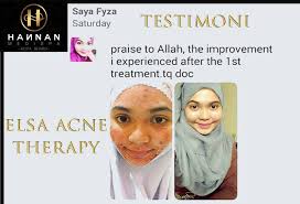 Best spa resorts in alor setar on tripadvisor: Hannan Medispa Alor Setar Photos Facebook