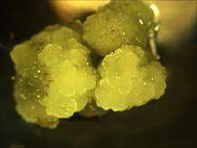 Maybe you would like to learn more about one of these? Callus Cell Biology Wikipedia
