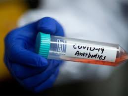 Компания cansino biologics была основана в 2009 году в тяньцзине юй сюэфэном, чжу тао, цю дунсю и хелен мао хуэйхуа. Covid 19 List Of Those In The Race For A Vaccine Cansino Biological Beijing Institute Of Biotechnology The Economic Times