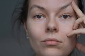 30 Fantastic Ways to Use Witch Hazel Around Your Home