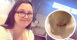 Glasgow mum says stranger saved her life by noticing cancer growing