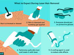 Laser hair removal is a medical service that should be performed by a medical professional. Laser Hair Removal Benefits Safety What To Expect