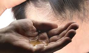 In cases of a sudden hair loss, make sure to consult your healthcare provider as it could. Hair Loss Treatment Garlic Gel May Promote Hair Growth Express Co Uk