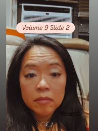 Radiation Roundup Number 5. (I skipped 4 because I had nothing to say.)  Today was F*%k Cancer Day. @mbcglobalalliance @saratogahospital  #adudewithbreastcancer #cancerhatesexercise #changingthefaceofbreastcancer  #breastcancerawareness #malebreastcancer ...