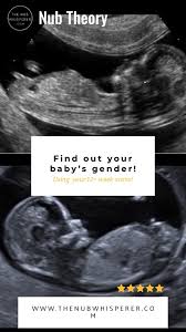 Boy Or Girl Nub Theory Video In 2020 Gender Prediction Baby Gender Prediction Ultrasound Gender Prediction