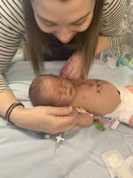 Hypoplastic Left Heart Syndrome: Edison's Story - Tiny Tickers