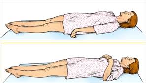 Facebook Las posiciones de descerebración y decorticación son dos posturas espontáneas y anormales del cuerpo humano que permiten al doctor realizar el diagnóstico de alguna alteración profunda del.
