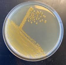 Exiguobacterium aurantiacum