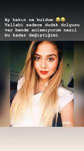 We did not find results for: Merve Taskin In Estetiksiz Hali Sasirtti Fenoreporter