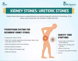 Kidney Stone Surgery Treatment Symptoms Apollo Spectra