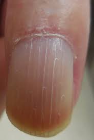 Complex Regional Pain Syndrome Type Ii After A Brachial Plexus And C6 Nerve Root Injury Mdedge Dermatology