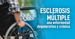 Con la esclerosis múltiple (em), el autodiagnóstico no es el camino a seguir. Esclerosis Multiple