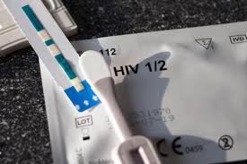 Möchtest du dich auf hiv testen lassen, ist es wichtig, das diagnostische zeitfenster zu berücksichtigen. Alles Zum Hiv Test Deutsche Aidshilfe