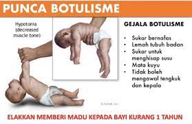 Penyakit ini disebabkan oleh bakteri clostridium botulinum yang pada dasarnya sering ditemukan pada tanah dan juga air yang kotor. Ini Apa Ibu Bapa Perlu Tahu Tentang Penyakit Botulisme