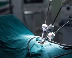 صورة minimally invasive surgery