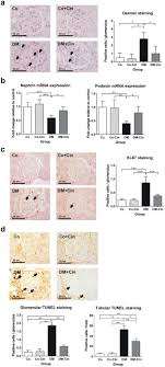 Each installment bringing together friends old and new in a spirit of collaboration and togetherness. Cinaciguat Ameliorates Glomerular Damage By Reducing Erk1 2 Activity And Tgf Ss Expression In Type 1 Diabetic Rats Scientific Reports
