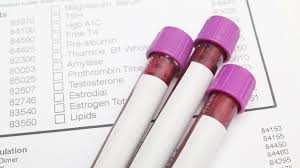 alt alanin aminotransferaz nedir alt yuksekligi ve dusuklugu ne anlama gelir saglik son dakika haberler