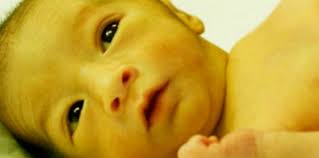 Apabila bayi kuning tidak berbahaya dan bisa dirawat di rumah, dokter mungkin akan menyarankan bayi agar lebih sering disusui dan dijemur di bawah sinar matahari pagi. Cara Hilangkan Kuning Bayi Rawatan Yang Sesuai Disyorkan Doktor Theasianparent Malaysia