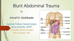 Image result for PECARN Pediatric Intra-Abdominal Injury Algorithm
