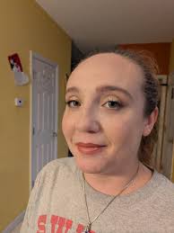 Say what? She now looks like severe aids patients of the 80's.