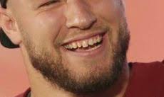 Will Compton Bad Teeth 2