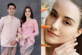 Loyd Christina Siapa? Profil dan Biodata Kekasih Ady Sky Asal Brazil yang  Kabarnya akan Segera Menikah: Umur, Instagram