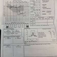 Just Had My Hearing Test Done Audiologist Says I Have