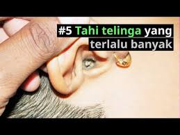 Di bawah ini tertera kumpulan beberapa contoh doa katolik lain untuk memohon tuhan menyembuhkan dan mengangkat sakit yang diderita oleh seseorang. Sakit Telinga Ear Pain Punca Cara Menyembuhkan Doctoroncall