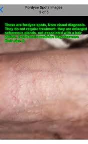 Venereal diseases are also known as stds or sexually transmitted diseases. 20 Sexually Transmitted Diseases Ideas Sexually Transmitted Diseases Sexually Transmitted Disease