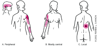 Muscles of the back can be divided into superficial, intermediate, and deep group.since the all the back muscles originate in embryo (fetus) form by locations other than the back. Trigger Points Diagnosis And Management American Family Physician