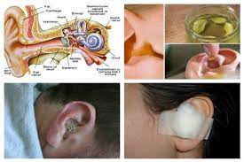 Say Goodbye To Ear Infection Cure Ear Infection In Just 1 Day 100 Percent Naturally Ear Infection Cure Ear Infection Fluid In Ears