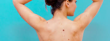 While not as common as the other causes, basal cell skin cancer can show up on the … 10 Signs Of Skin Cancer You Shouldn T Ignore Self