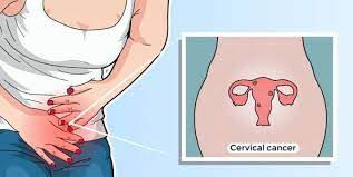 How do you get cervical cancer. Cervical Cancer Is Easily Preventable All You Need To Know About This Cancer Health News India Tv