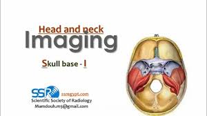 The skull includes the upper jaw and the cranium. Skull Base Imaging I Dre 19 Prof Dr Mamdouh Mahfouz Youtube